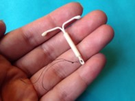 Intrauterine device (IUD)